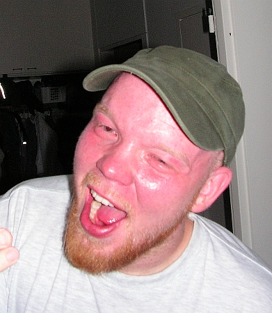 Fiery face